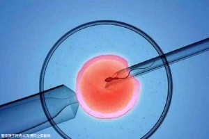 慈安中西医结合试管中心